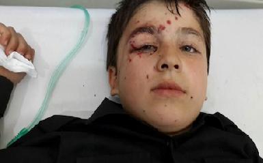 7 детей получили травмы от взрыва мины в иранской курдской деревне