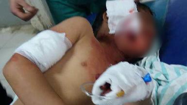 Сирия: ФАН публикует фото пострадавших от действий Турции жителей, доставленных в больницу Африна