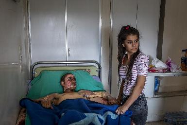 Фотография сирийского курдского бойца вошла в список номинантов на премию "World Press Photo"
