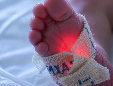 Больницы провинции Сулеймания сталкиваются с критической нехваткой оборудования